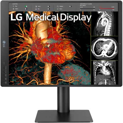 LG 21HQ613D medical diagnostic display price and release date